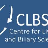 Transplant Liver India